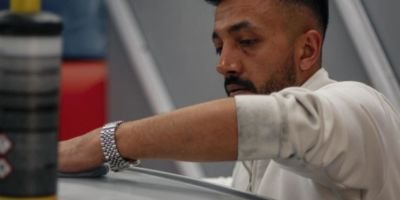 Güneş Yanıkları Onarım istanbul